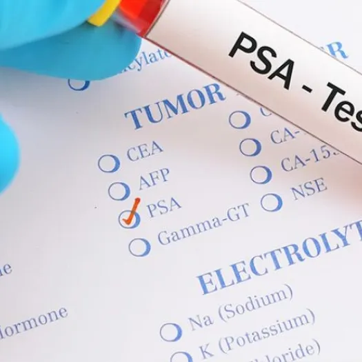 Prostate Cancer Test 03