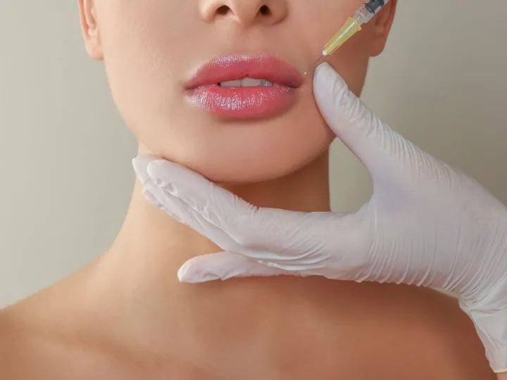 Lip Filler